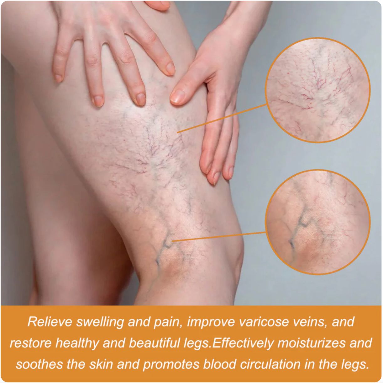 Venom Varicose Vein Relief Spray (BUY 1 GET 2 FREE ๐)